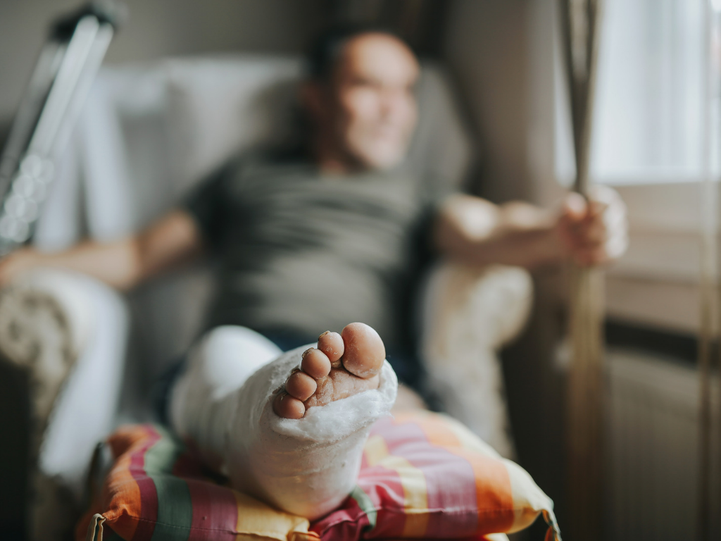 What Are The 3 Types of Amputations And Why You